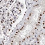SFRS15 Antibody in Immunohistochemistry (IHC)