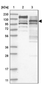 SFRS15 Antibody in Western Blot (WB)