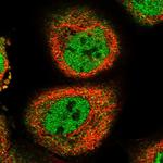 p53R2 Polyclonal Antibody