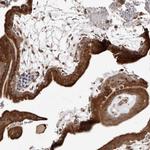 p53R2 Antibody in Immunohistochemistry (Paraffin) (IHC (P))