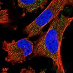 FREM2 Antibody in Immunocytochemistry (ICC/IF)