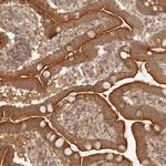 FREM2 Antibody in Immunohistochemistry (Paraffin) (IHC (P))