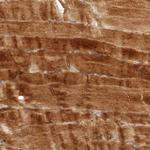 FREM2 Antibody in Immunohistochemistry (Paraffin) (IHC (P))