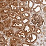 FREM2 Antibody in Immunohistochemistry (IHC)