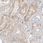 LMLN Antibody in Immunohistochemistry (Paraffin) (IHC (P))