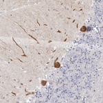LMLN Antibody in Immunohistochemistry (Paraffin) (IHC (P))
