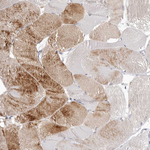 LMLN Antibody in Immunohistochemistry (Paraffin) (IHC (P))