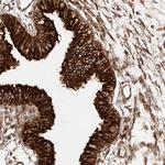 NAP1L1 Polyclonal Antibody