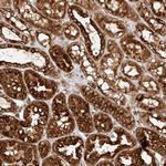 NAP1L1 Antibody in Immunohistochemistry (Paraffin) (IHC (P))