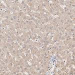 NAP1L1 Antibody in Immunohistochemistry (Paraffin) (IHC (P))