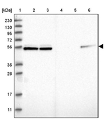 NAP1L1 Antibody in Western Blot (WB)