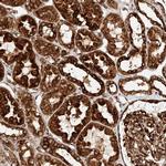 NAP1L1 Antibody in Immunohistochemistry (IHC)