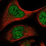 ELK4 Antibody in Immunocytochemistry (ICC/IF)