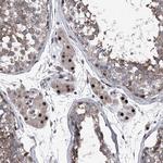ELK4 Antibody in Immunohistochemistry (Paraffin) (IHC (P))