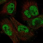 UBOX5 Polyclonal Antibody