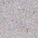 UBOX5 Antibody in Immunohistochemistry (Paraffin) (IHC (P))