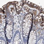 UBOX5 Antibody in Immunohistochemistry (Paraffin) (IHC (P))