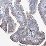 UBOX5 Antibody in Immunohistochemistry (Paraffin) (IHC (P))
