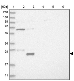 UBE2E2 Antibody in Western Blot (WB)