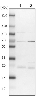 UBE2E2 Antibody in Western Blot (WB)