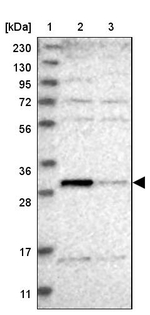 THTPA Antibody in Western Blot (WB)