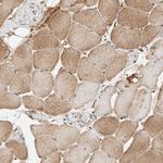 THTPA Polyclonal Antibody