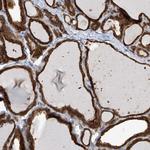 OR4K1 Polyclonal Antibody
