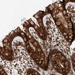 ZFP28 Antibody in Immunohistochemistry (Paraffin) (IHC (P))