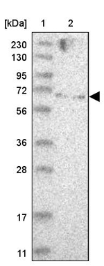ZNF274 Antibody in Western Blot (WB)