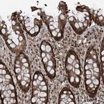 ZNF570 Antibody in Immunohistochemistry (Paraffin) (IHC (P))