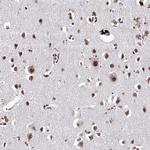 PHF5A Antibody in Immunohistochemistry (Paraffin) (IHC (P))