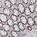 PHF5A Antibody in Immunohistochemistry (Paraffin) (IHC (P))