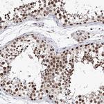 PHF5A Antibody in Immunohistochemistry (Paraffin) (IHC (P))