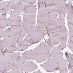 RNF36 Polyclonal Antibody