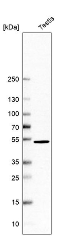 RNF36 Antibody in Western Blot (WB)