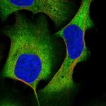 AKAP10 Polyclonal Antibody