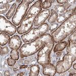 AKAP10 Antibody in Immunohistochemistry (Paraffin) (IHC (P))