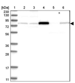 AKAP10 Antibody in Western Blot (WB)
