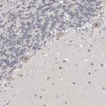 SRCAP Antibody in Immunohistochemistry (Paraffin) (IHC (P))