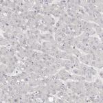 SRCAP Antibody in Immunohistochemistry (Paraffin) (IHC (P))