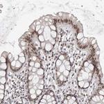 SRCAP Antibody in Immunohistochemistry (IHC)