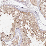 ELL3 Antibody in Immunohistochemistry (Paraffin) (IHC (P))
