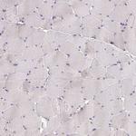 ELL3 Antibody in Immunohistochemistry (Paraffin) (IHC (P))