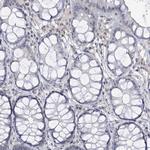Centrin 1 Antibody in Immunohistochemistry (Paraffin) (IHC (P))
