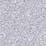 Centrin 1 Antibody in Immunohistochemistry (Paraffin) (IHC (P))