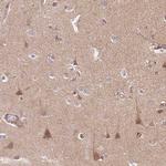 APLP1 Polyclonal Antibody