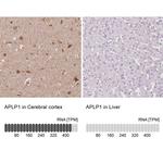 APLP1 Antibody in Immunohistochemistry (IHC)