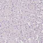 APLP1 Antibody in Immunohistochemistry (IHC)