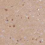 APLP1 Antibody in Immunohistochemistry (IHC)