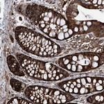 ZNF484 Antibody in Immunohistochemistry (Paraffin) (IHC (P))